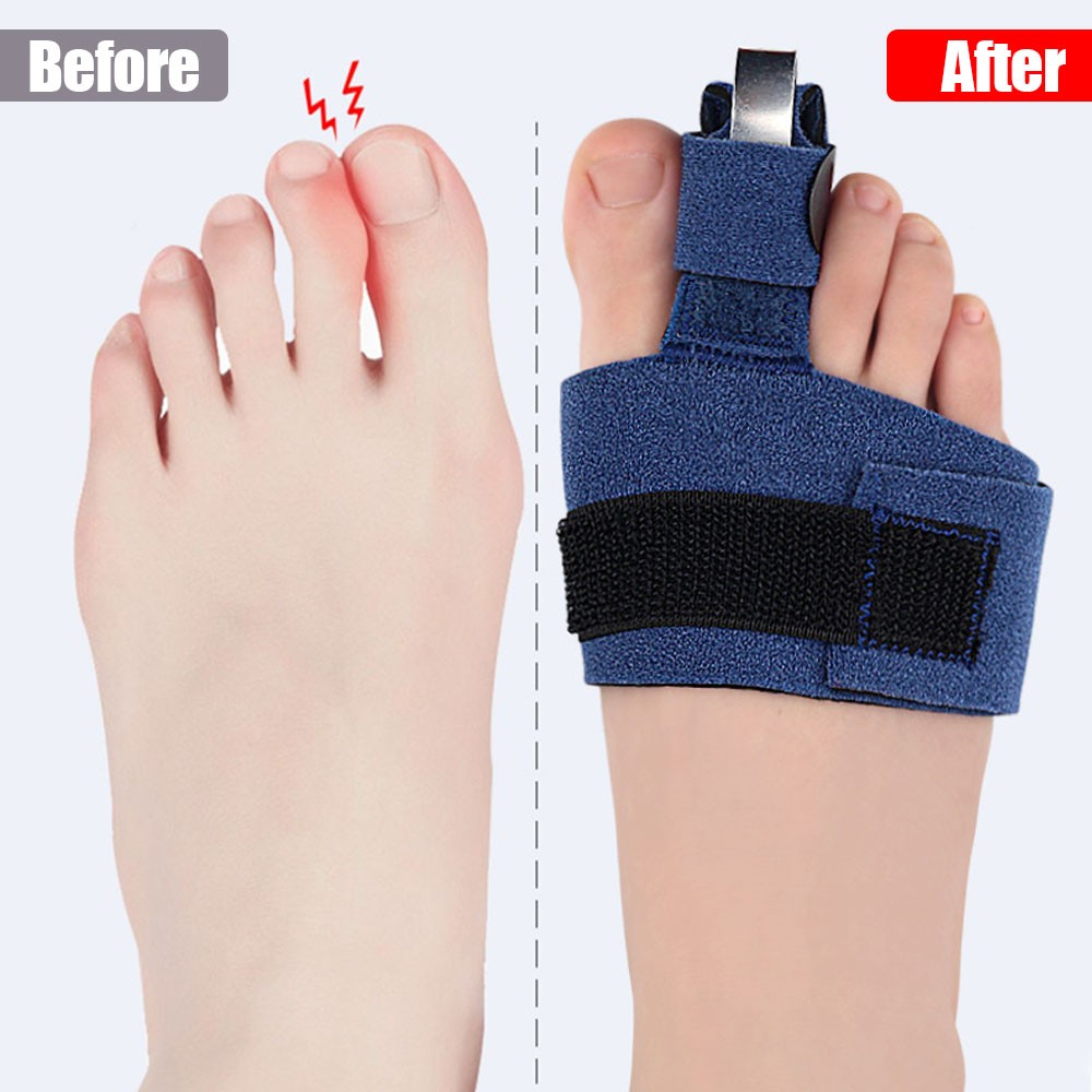 Toe Straightener Splint Corrector Toe Wrap For Hammer Toe Bent Claw Crooked