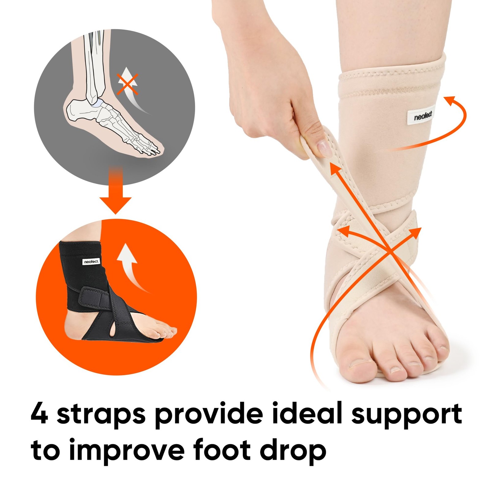 NEOFECT Drop Foot Brace Beige – Adjustable AFO Ankle Brace for Walking Strok…