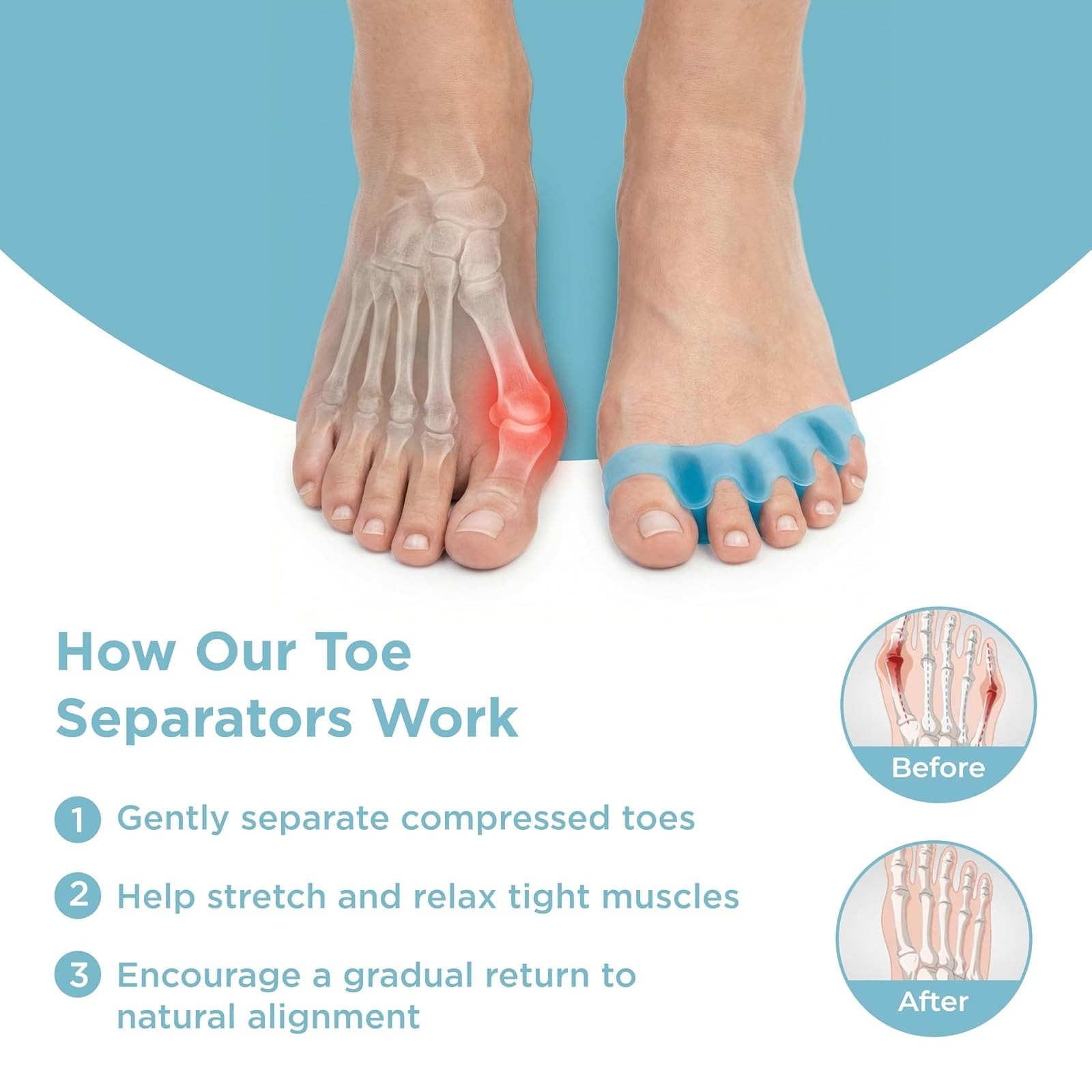 Toe Separators Toe Spacers Bunion Support Gel Black MIND BODHI