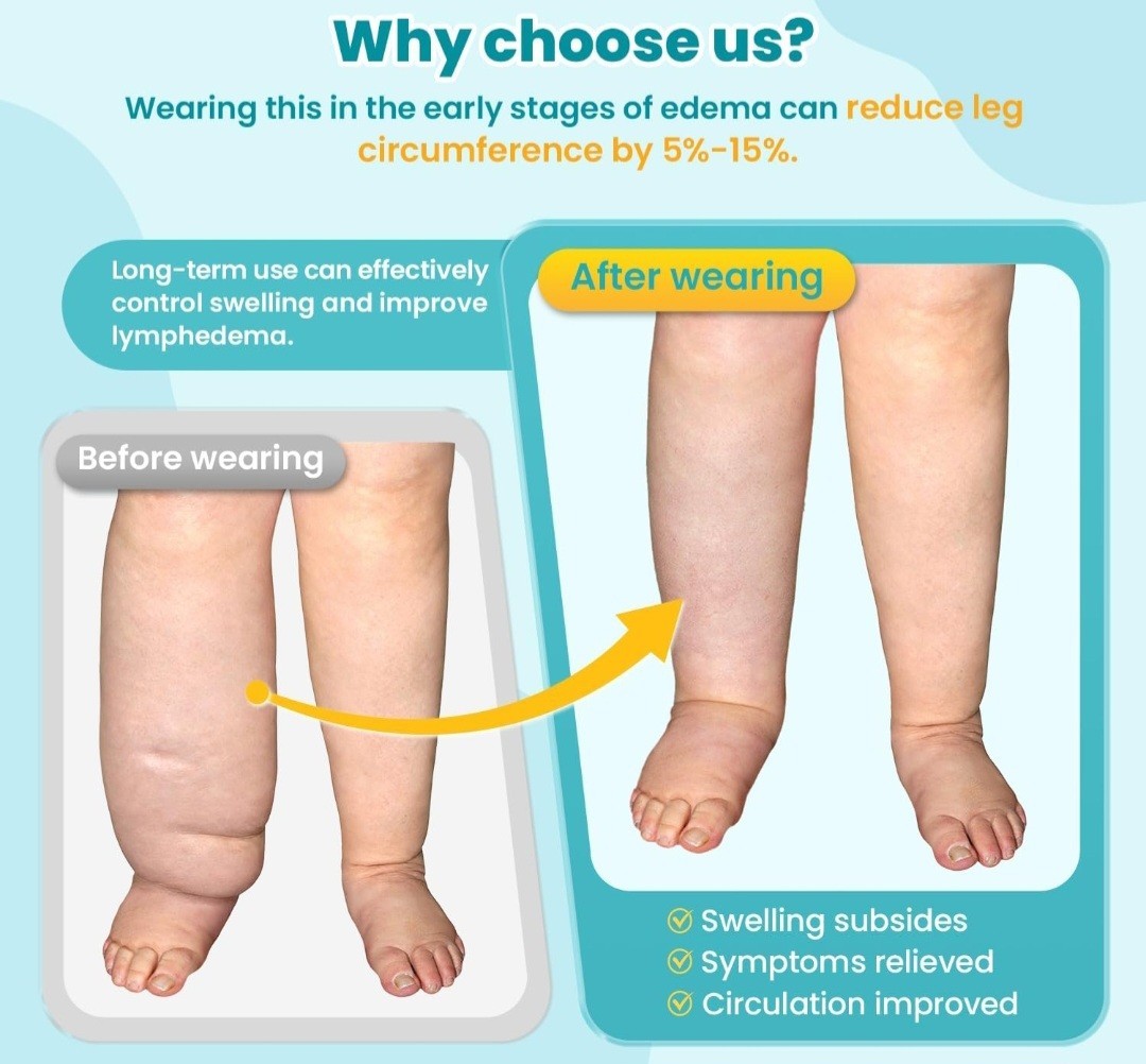 Sylong Adjustable Calf Compression Wrap Lymphedema Circulation XL Black