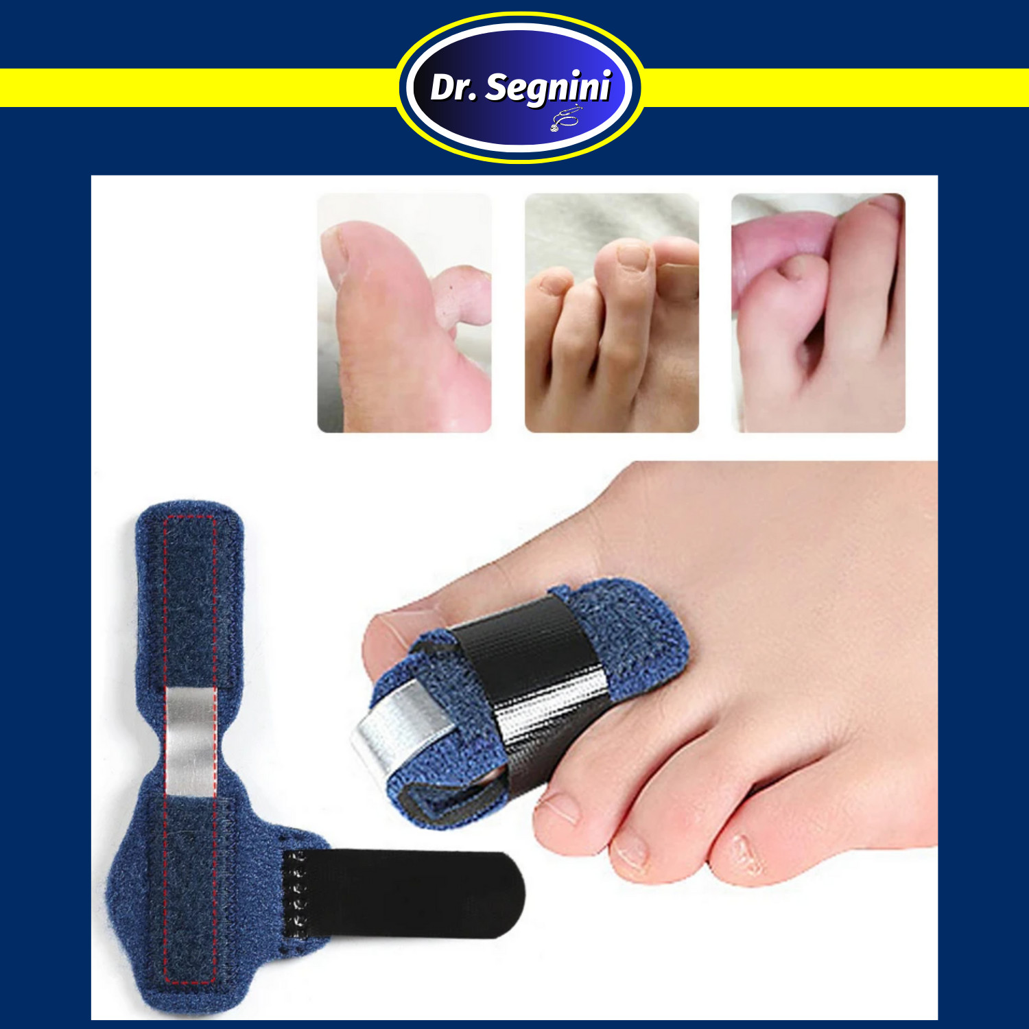 1 Pcs Toe Corrector Adjustable Splint Straightener Brace Support