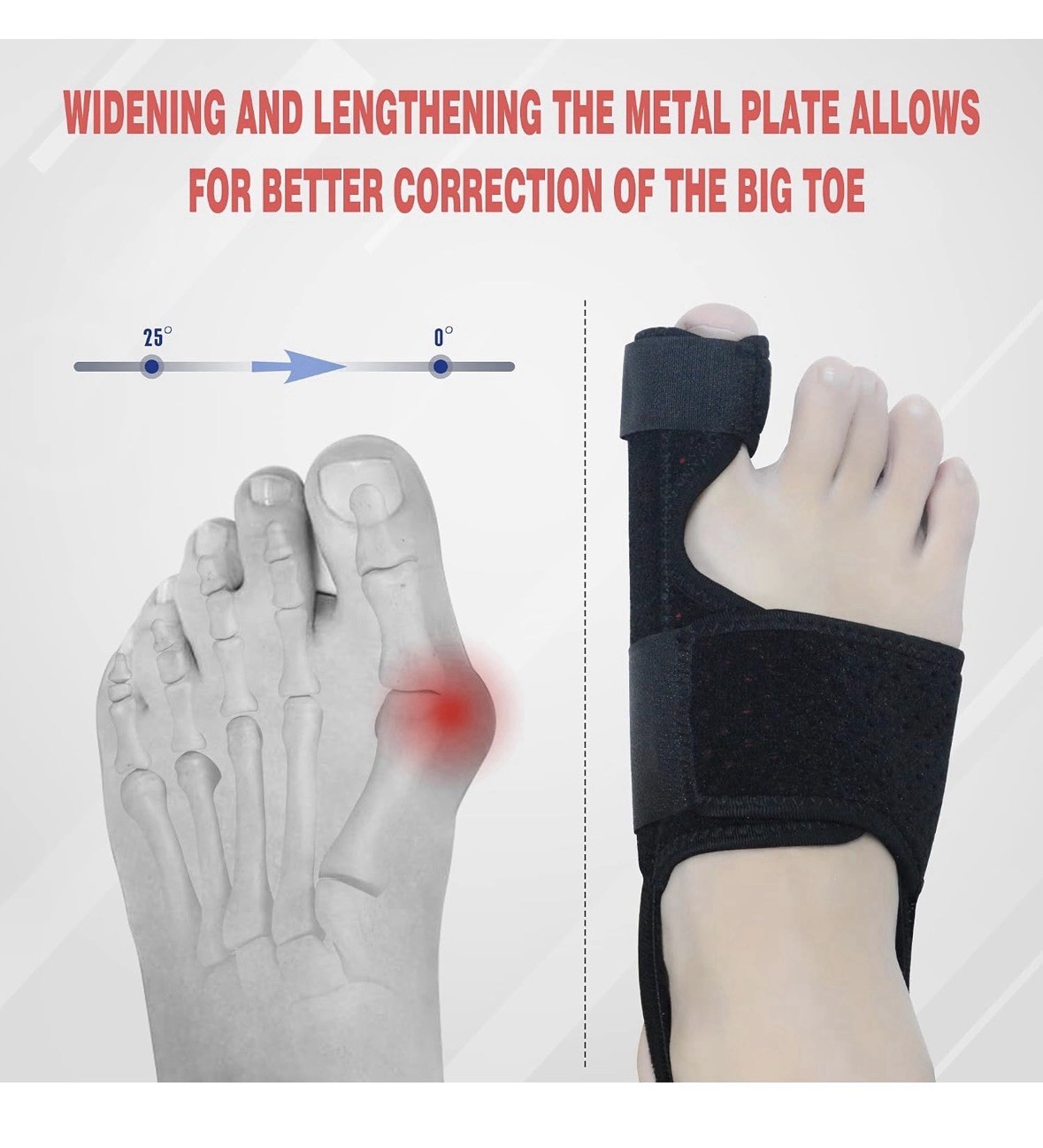 Adjustable Black Orthopedic Bunion Corrector Toe Splint w/ Aluminum Plate