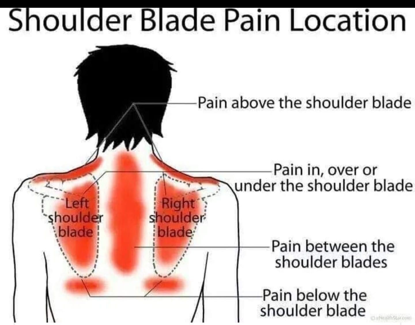 Full Back Brace, Shoulders/Shoulder Blade and Posture Support Short Sleeve Vest