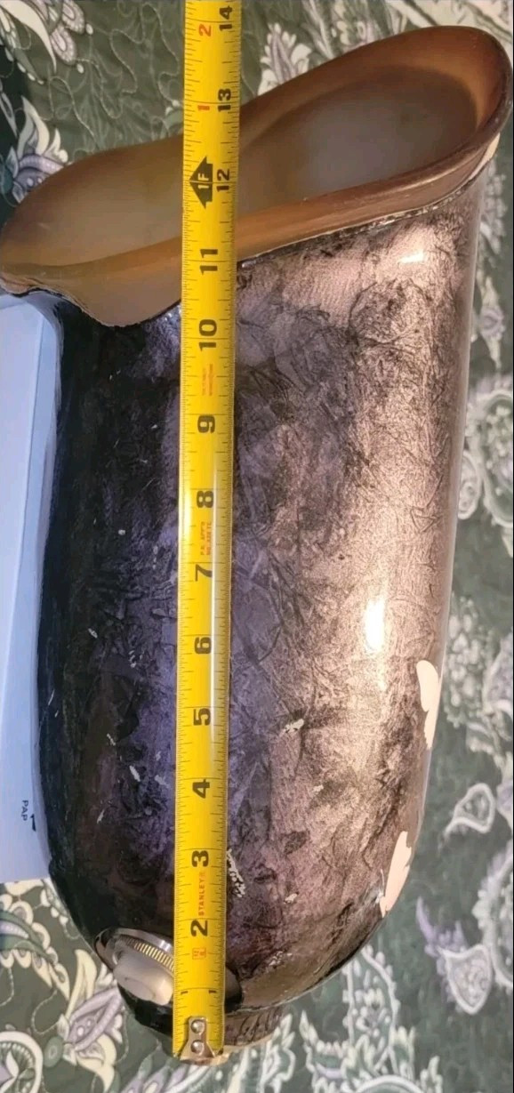 Above Knee Prosthetic Socket Lefts leg Made of 100% Carbon Fiber it’s perfect.