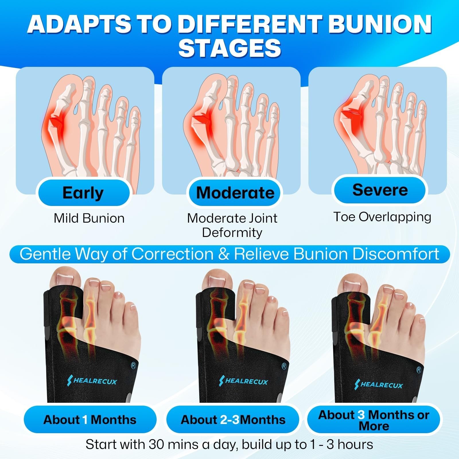 Adjustable Bunion Corrector for Men & Women, Big Toe Straightener Splints with G