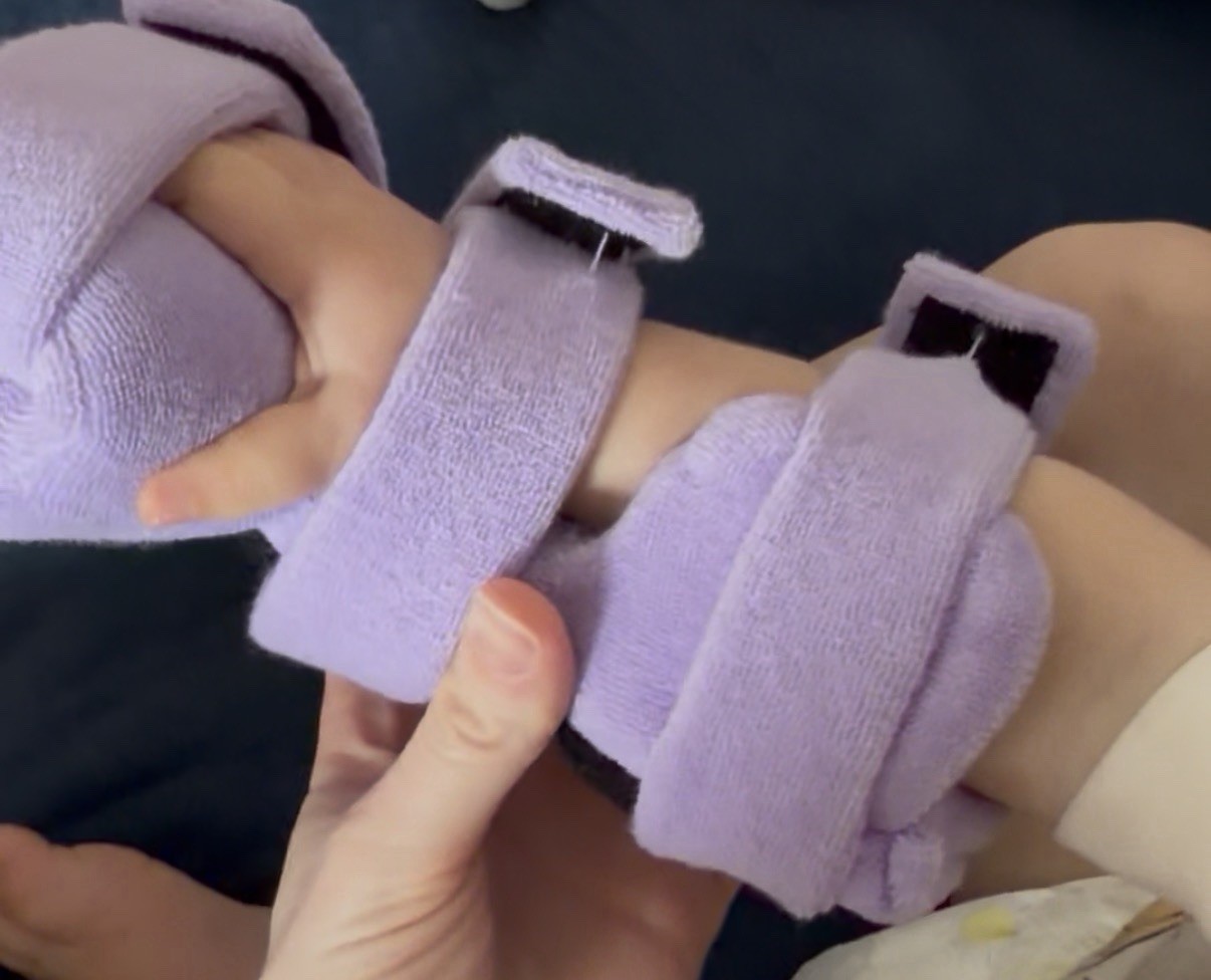 AliMed Comfy Splints Pediatric Opposition Hand/Thumb Orthosis for Right Hand