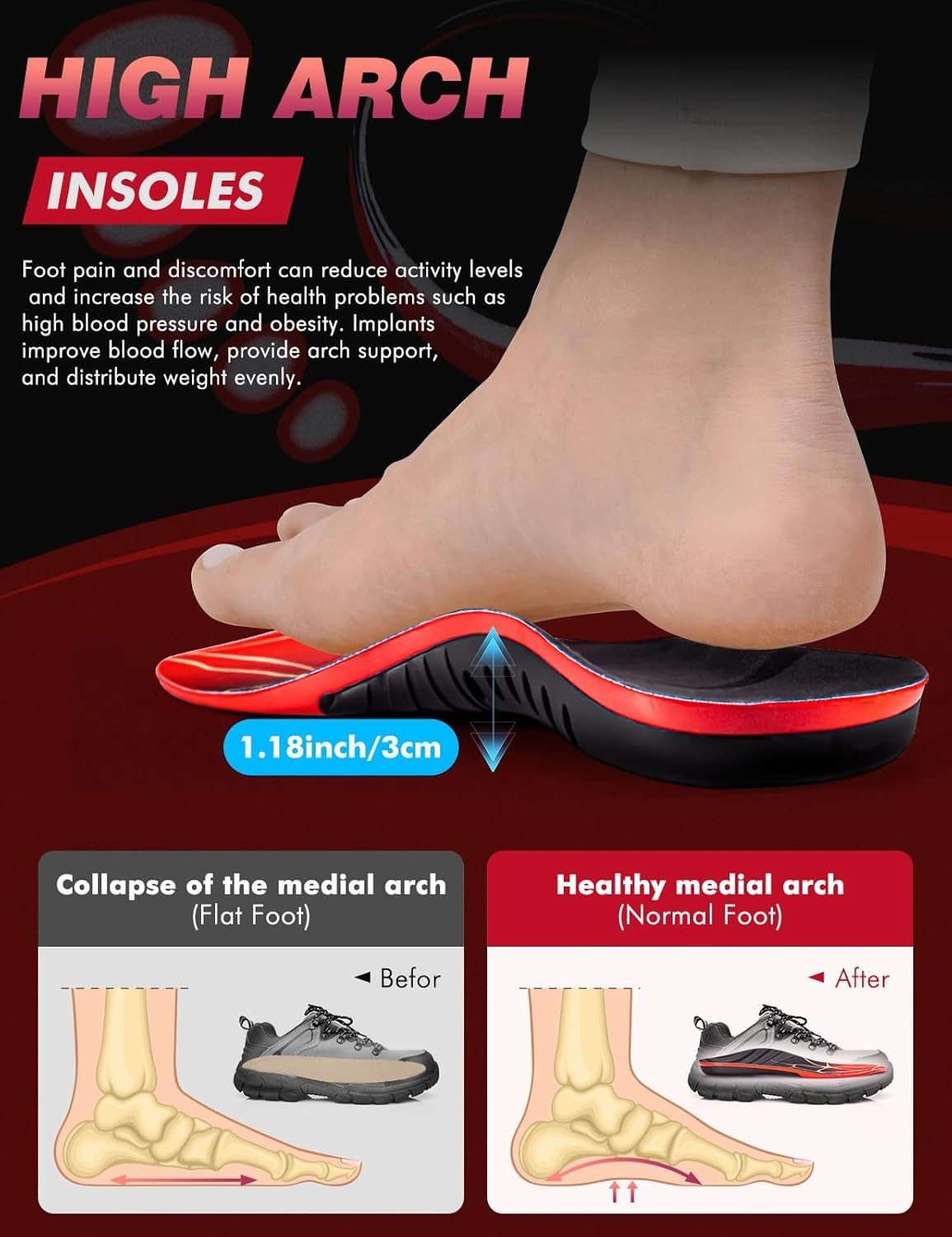 Plantillas para fascitis plantar para hombres con soporte de arco