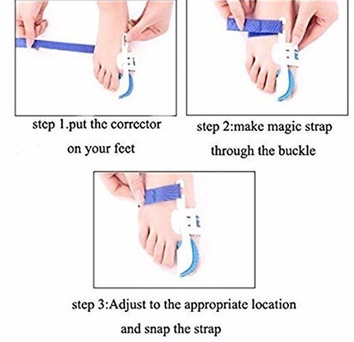 Toe Bunion Corrector & Relief Protector Treat Pain in Hallux Valgus Night Splint
