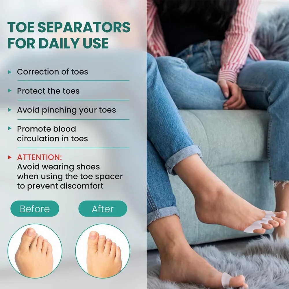 1 Pair Silicone Gel Bunion Toe Corrector Orthotics Straightener Separator Pain
