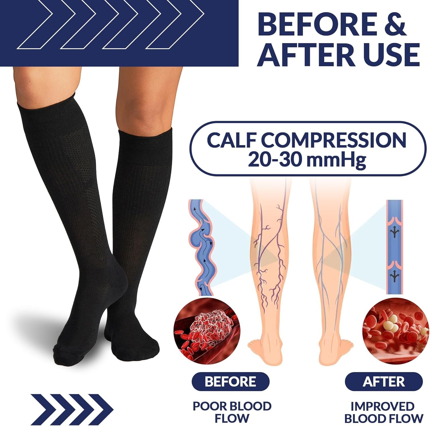 SB SOX COMPRESSION SOCKS (20-30) MM Hg – BLACK /PINK MEDIUM
