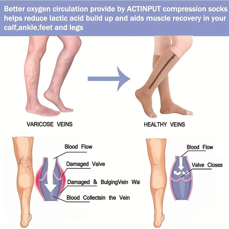 1 Pair Open Toe Stockings Compression Socks 20-30mmgh Unisex Black Or Beige