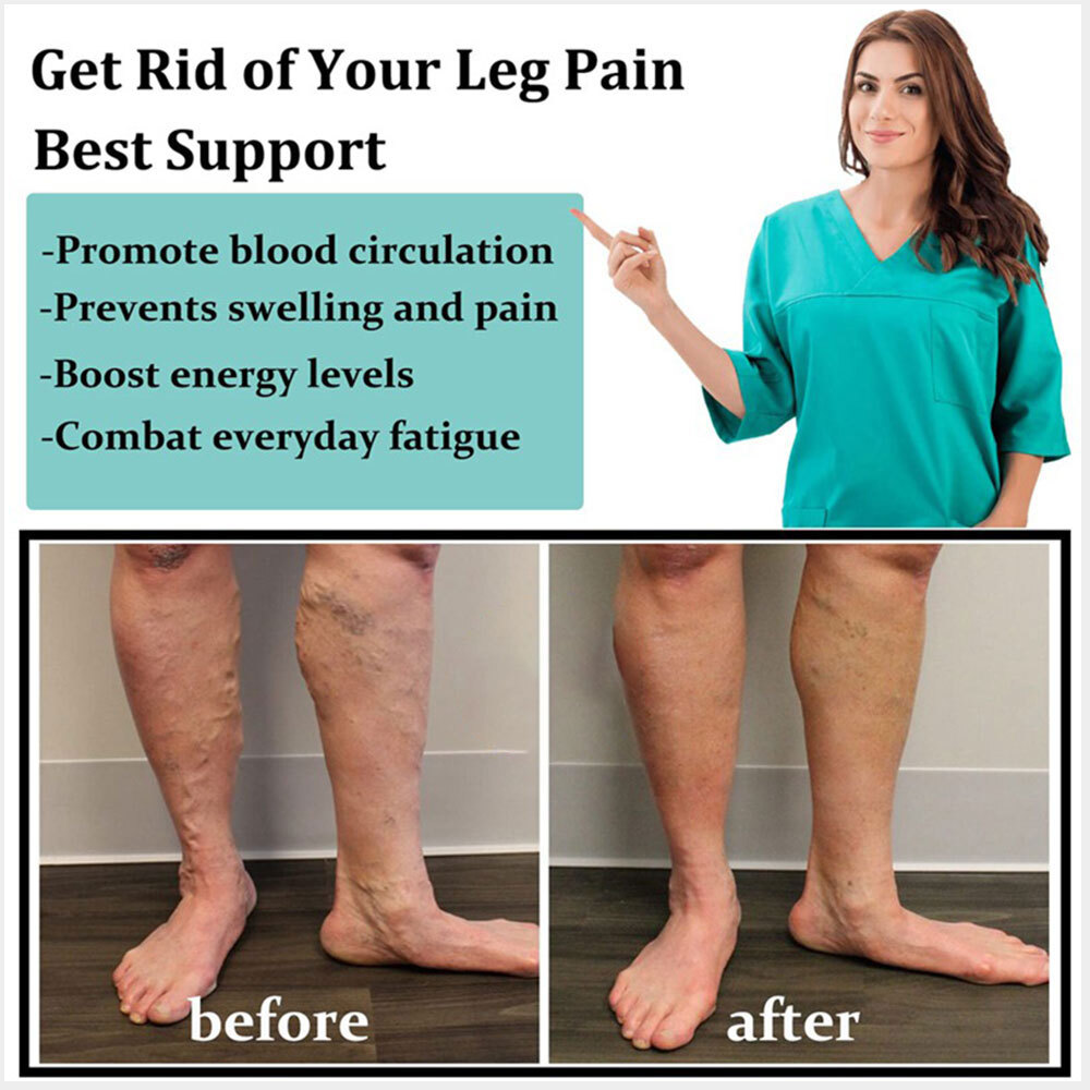 Calf-Length Compression Stockings 3 Pairs 20-30mmhg Medical Black,Beoge,White