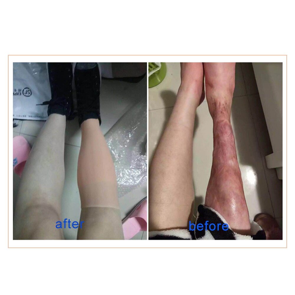 Skin Artificial Silicone Prosthesis Foot Sleeve Leg Cover Scars Highly Simulated