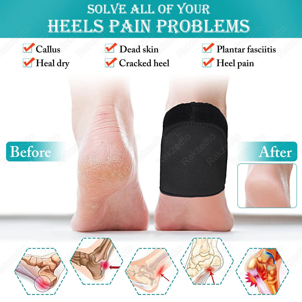 Silicone Gel Heel Socks for Dry Cracked Feet Moisturizing Heel Spurs Treatment P