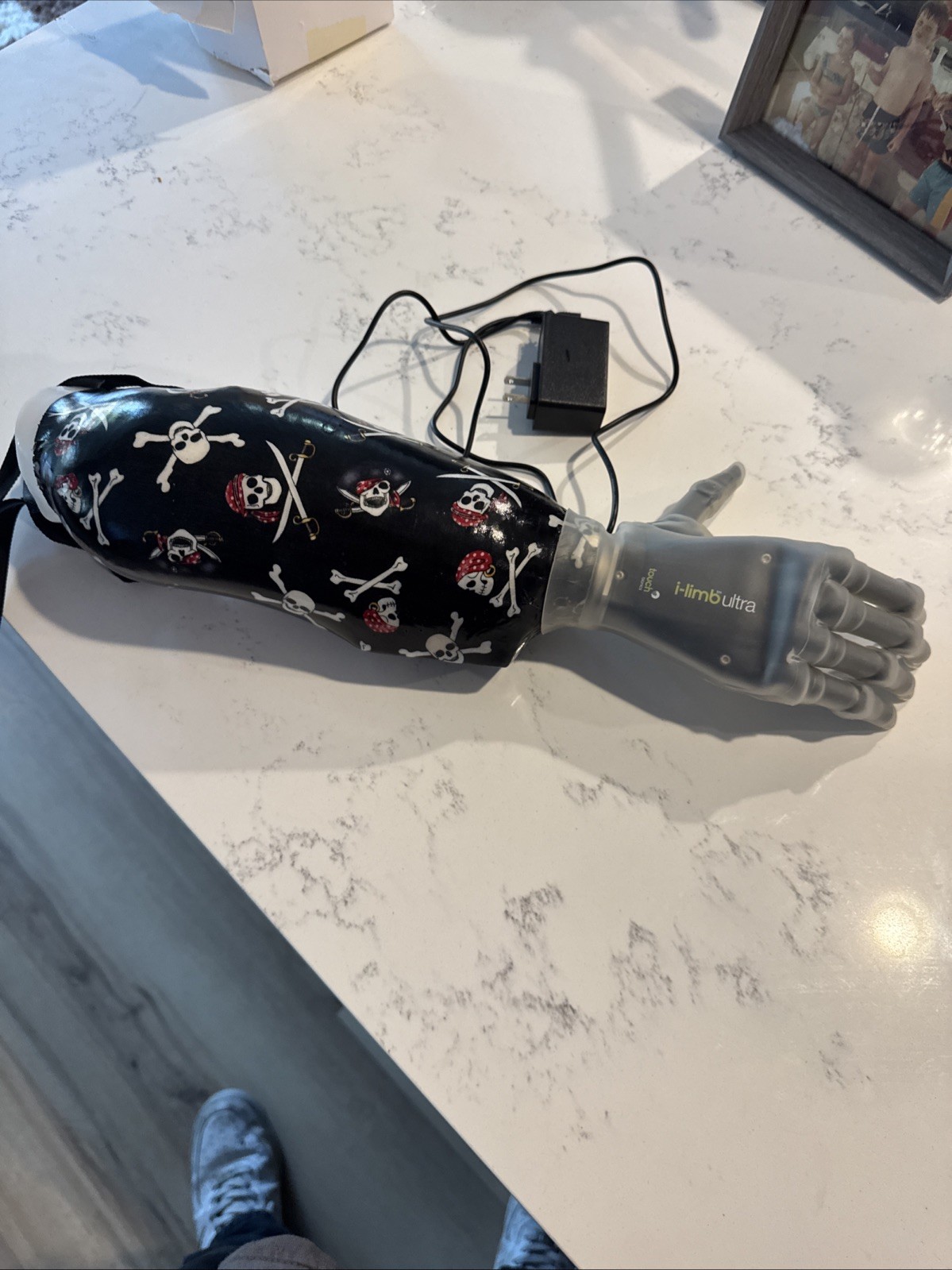 Touch Bionics i-Limb Ultra Right Myoelectric Prosthetic Arm Hand With Charger