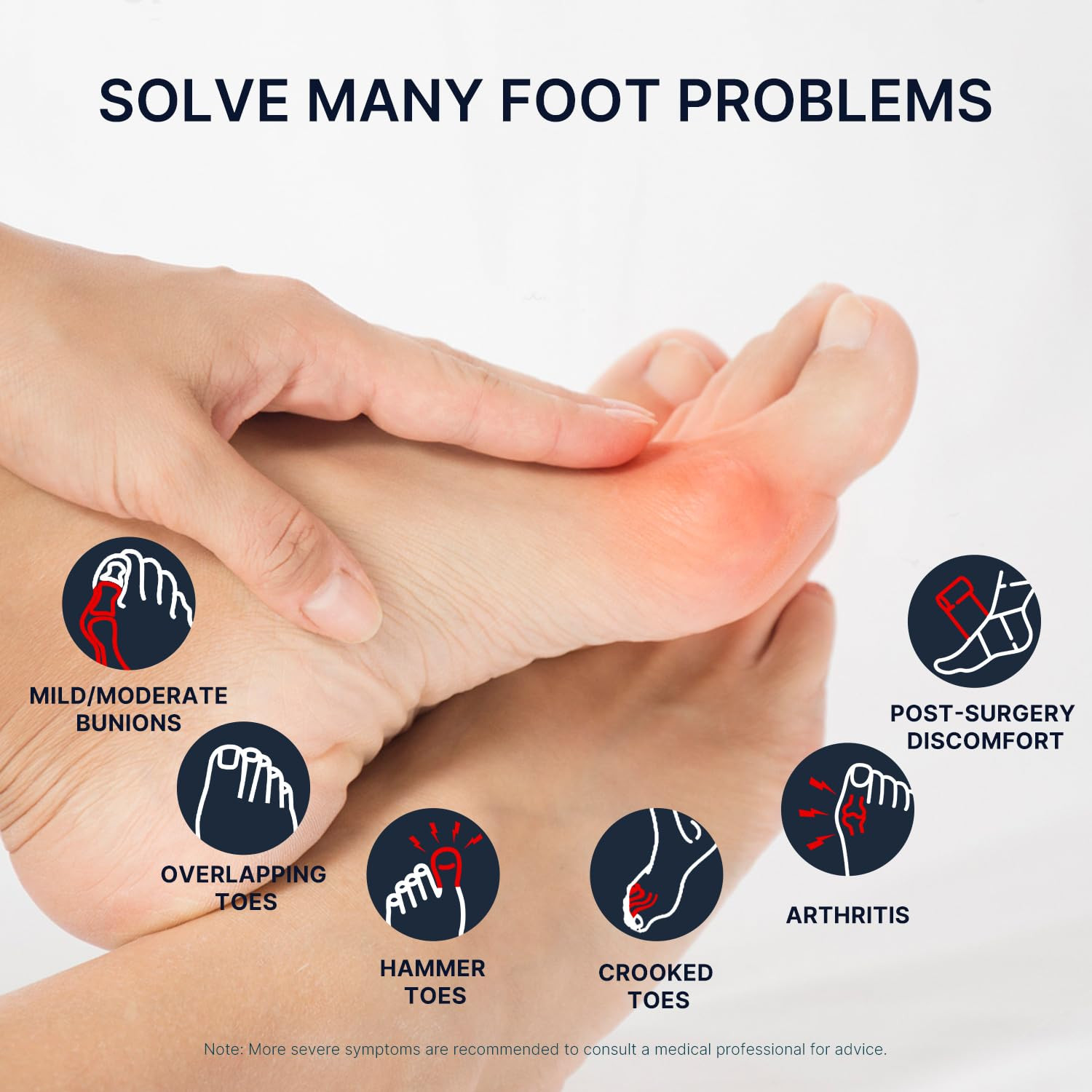 Adjustable Orthopedic Bunion Corrector Brace For Men And Women Relief