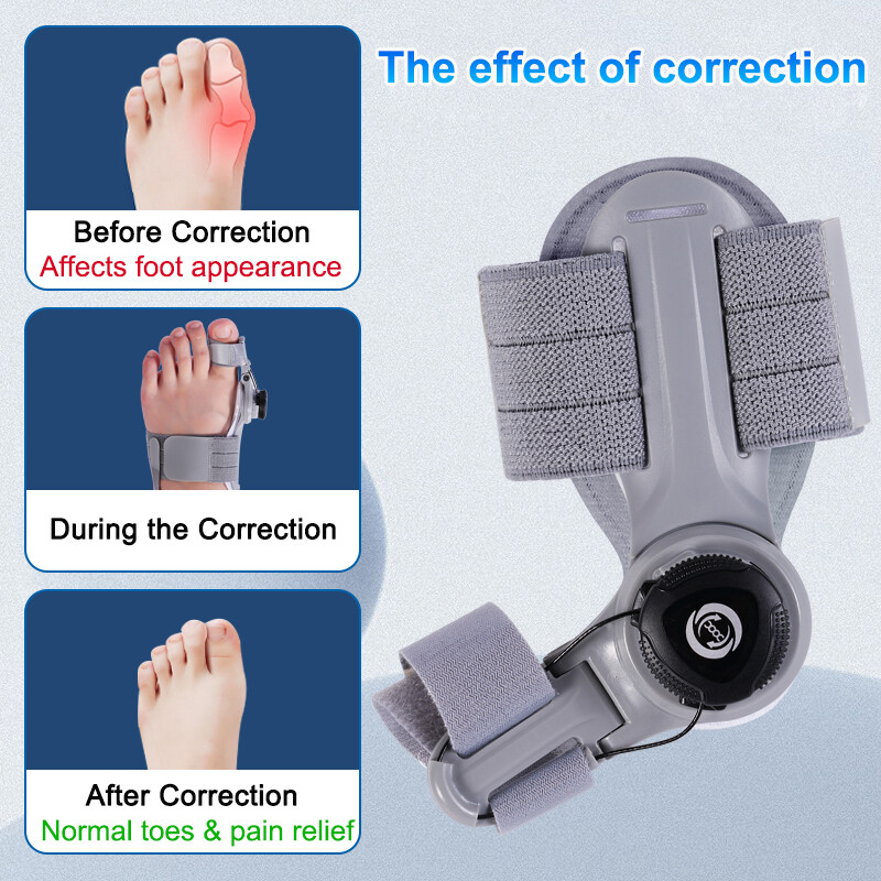 Orthopedic Big Toe Bunion Corrector Hallux Valgus Straightener Splint Support US