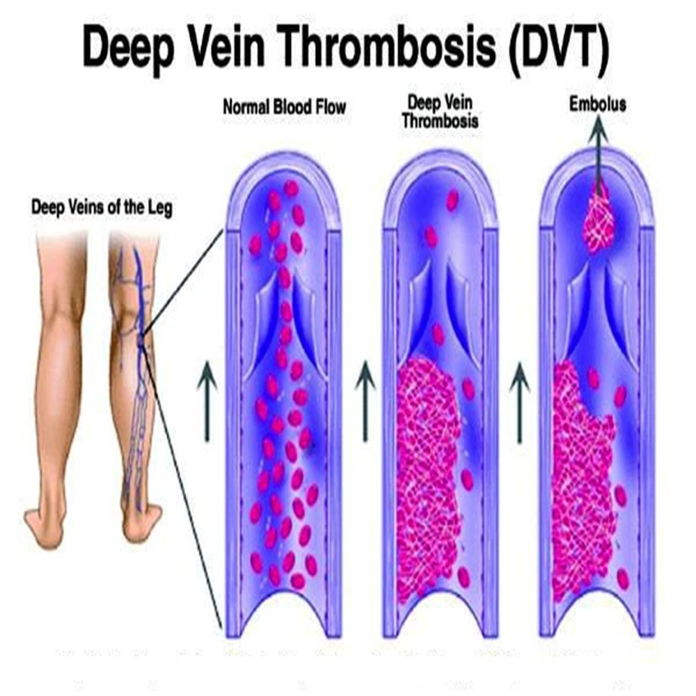 3/6 Packs Copper Compression Socks 20-30mmHg Graduated Support for Men Women