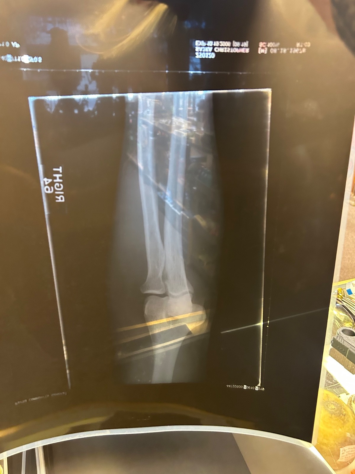 X-rays lot of 10 shoulder /ribs / Legs