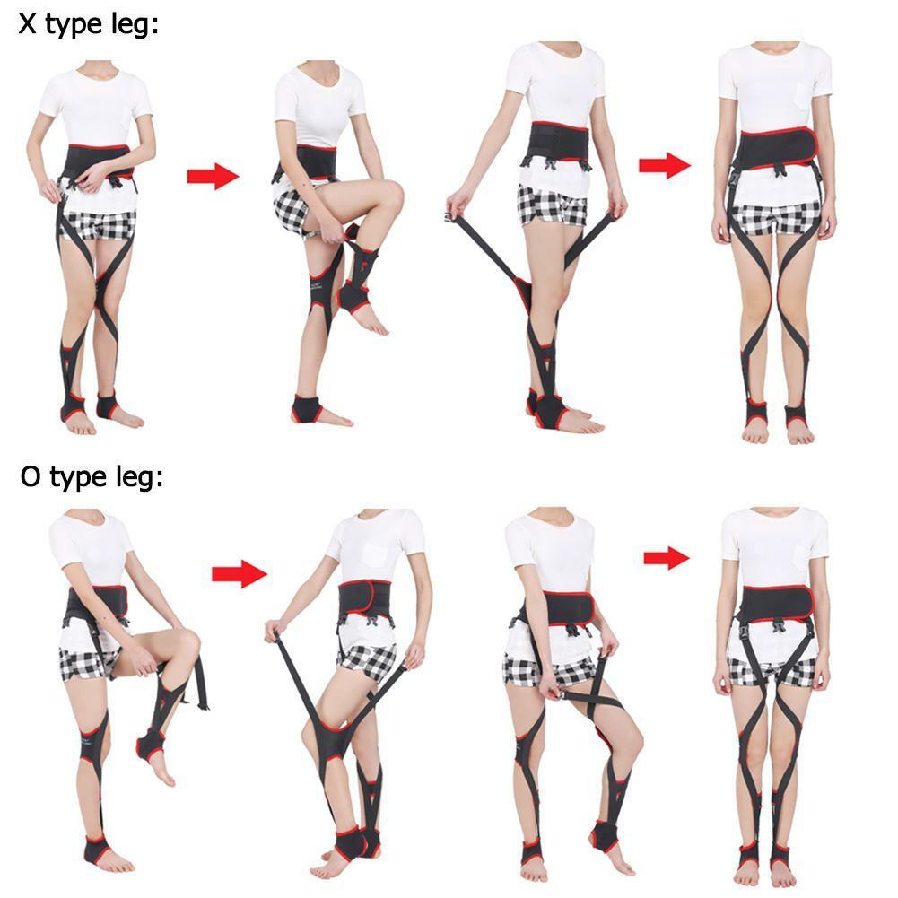 Adult Unisex O-leg X-leg Figure Correction Belt Strap Slim Legs Corrector Black