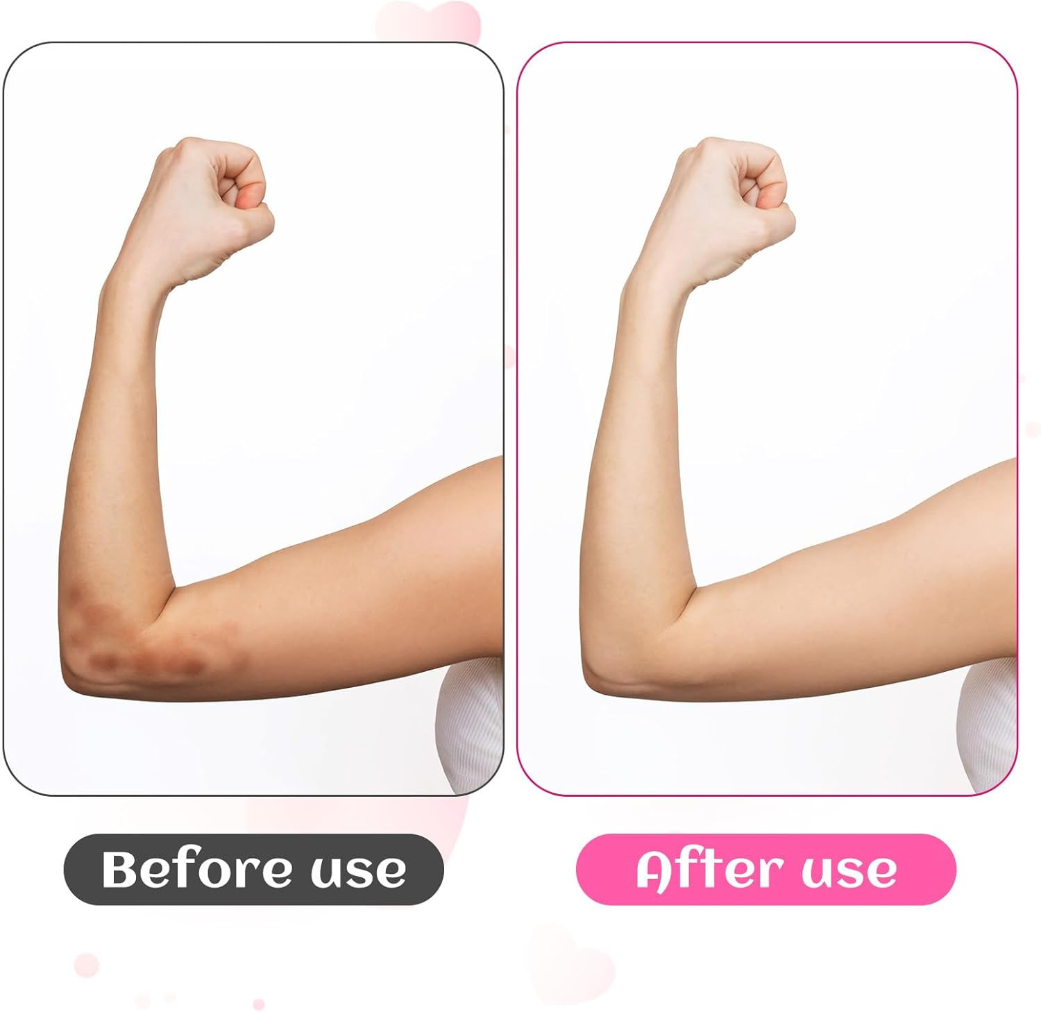 Piriuuo 2 Pairs/4 Pcs Elbow Moisturizing Sleeve, Elastic Gel Elbow Pads for Wome