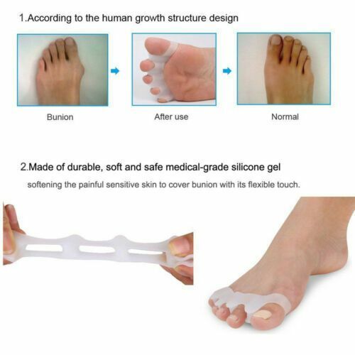 2-4Pcs Bunion Corrector Hammer Toe Straightener Splint Orthopedic Brace Silicone
