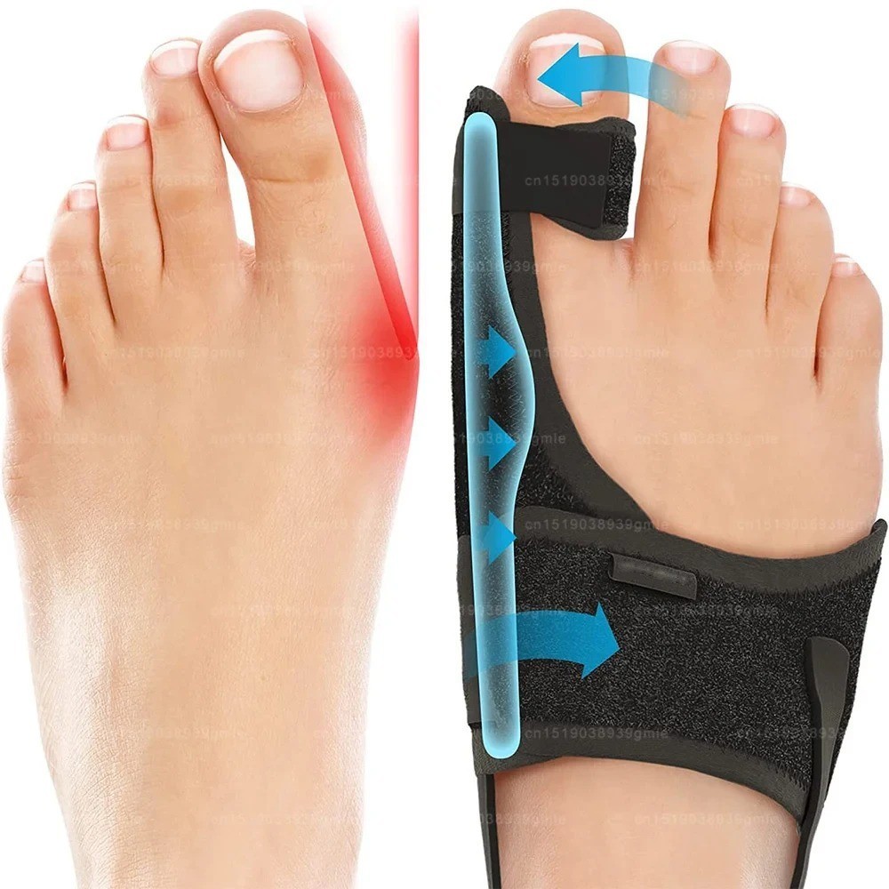 Recovist Bunion Corrector, Recovist Bunion Brace, Big Toe Straightener Bunions