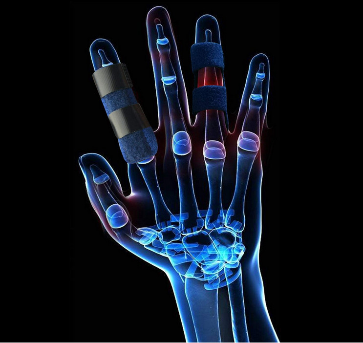 Premium Quality Compression Finger Splints with Flexible Built-in Aluminium Supp
