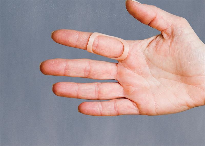 3pp Oval-8 Finger Splints (5 Pack Refill Kit)