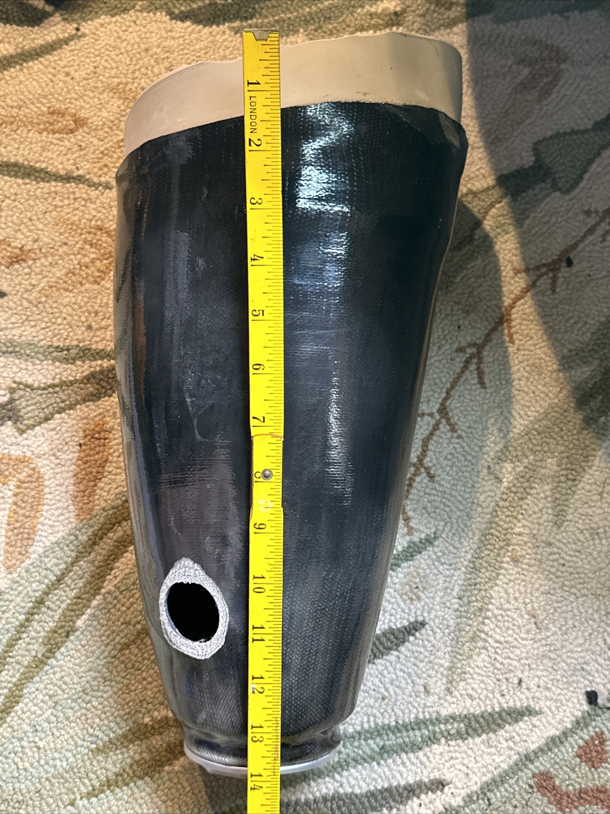 Right Above Knee Prosthetic Socket