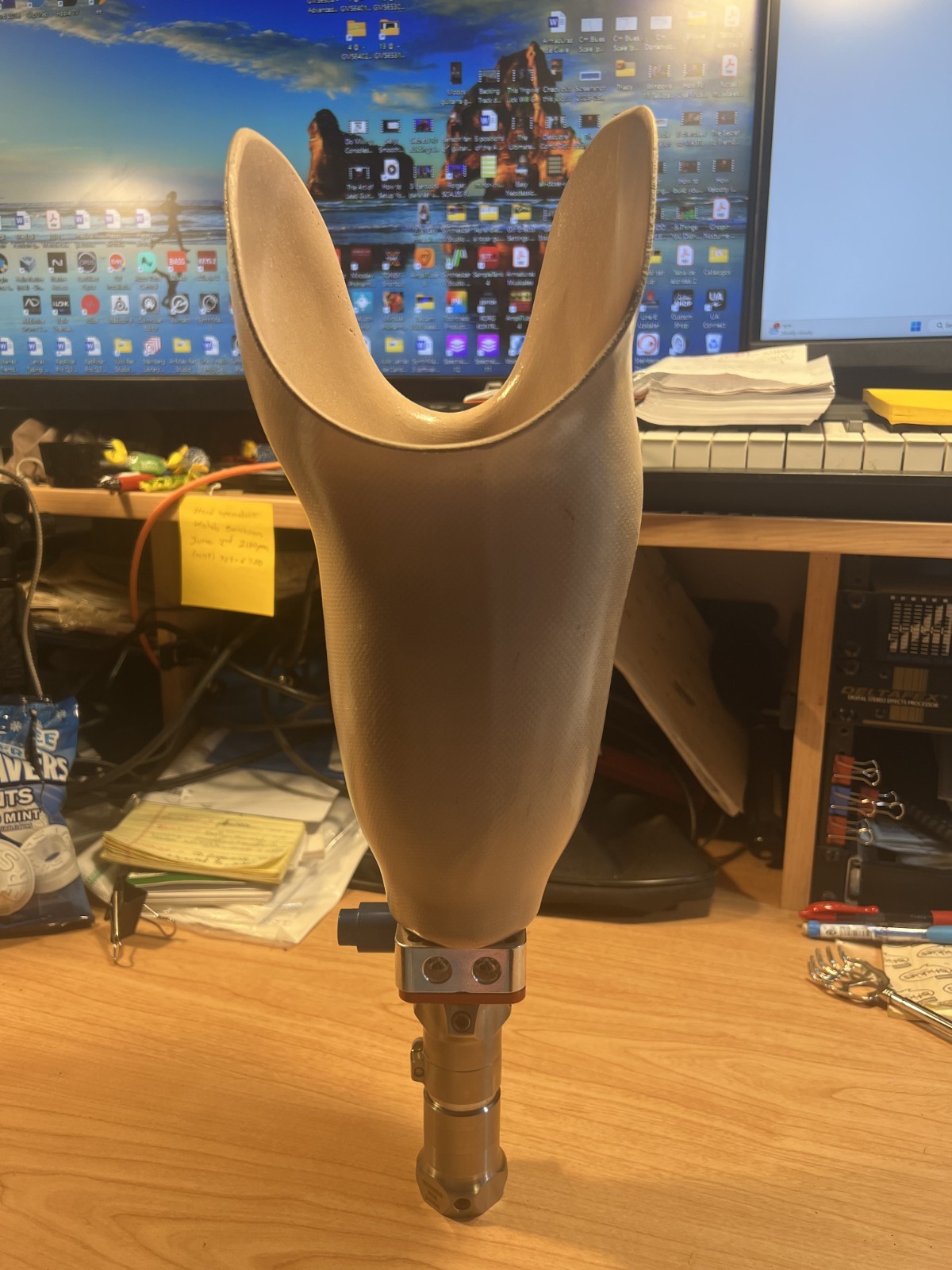 Prosthetic Socket with components. Right leg. Below Knee (BK). USED