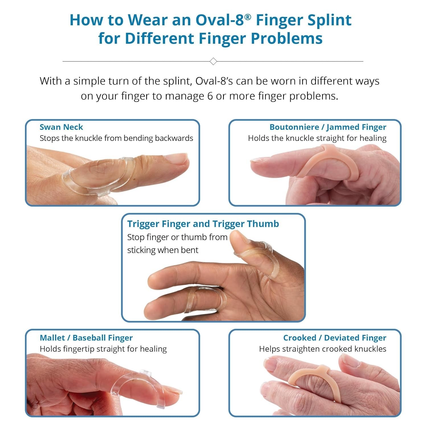 Oval-8 Finger Splint Size 13: Ultimate Support for Arthritis & Trigger Finger