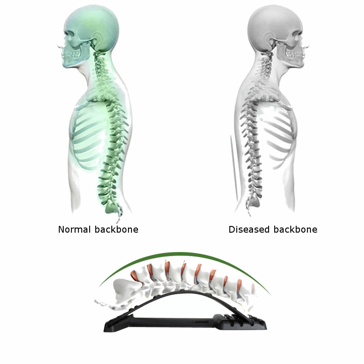 Back Muscle Stretcher Posture Corrector Lumbar Support Massage Tool Relaxing Kit