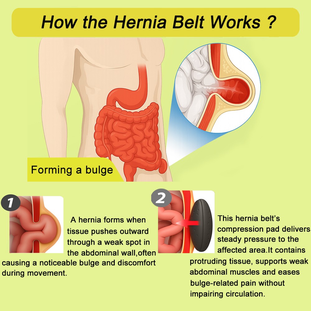 Men’s Umbilical Hernia Belt Abdominal Binder Support Navel Truss Compression Pad