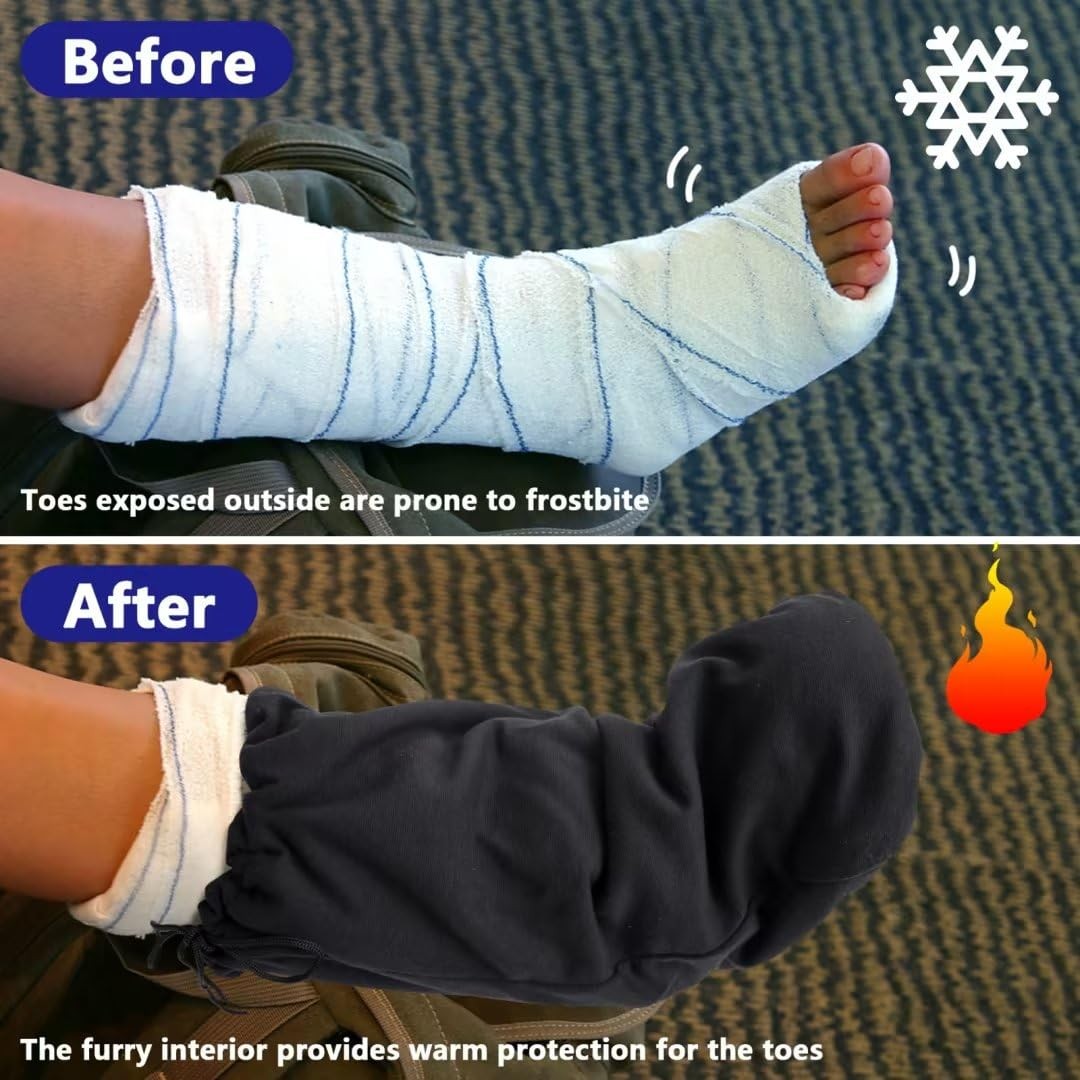 Shupakul 21 x 12.5 Inch Leg Cast Cover- Below the Knee One Size, 1 Pc