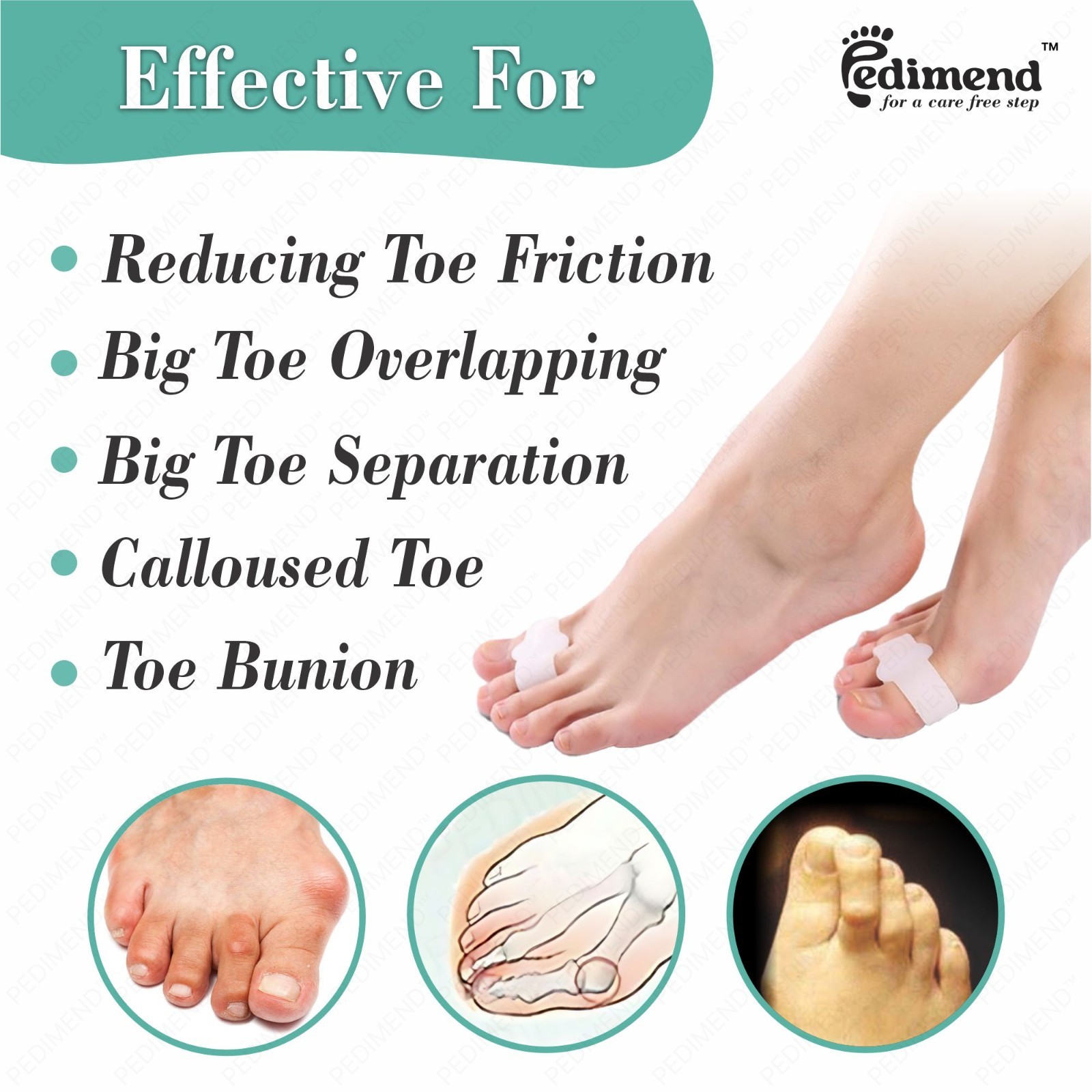 Pedimend™ Silicone Gel Double Loop Bunion Corrector Toe Separators & Toes Spacer