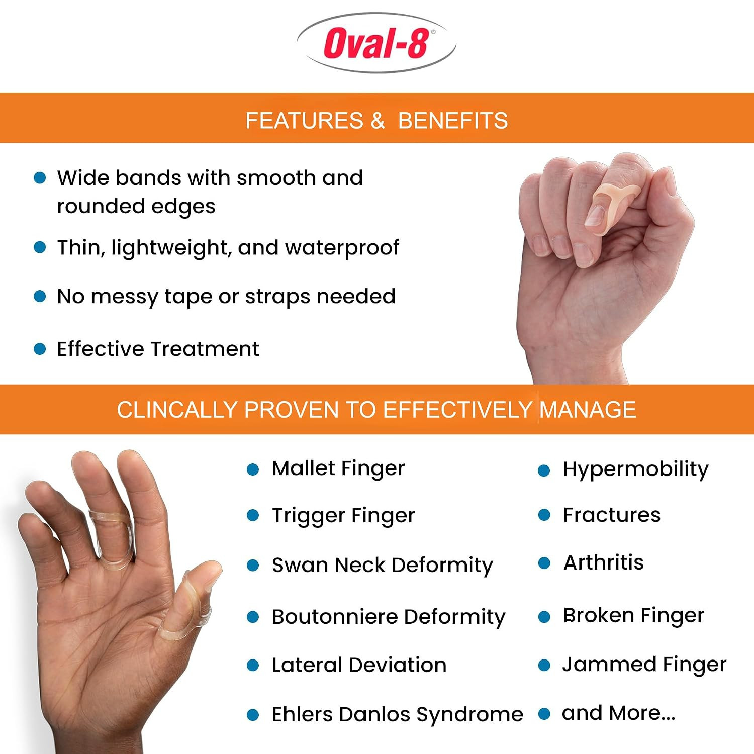 3-Point Products Oval-8 Finger Splint, Size 13, Pack of 1, Beige | Support and P