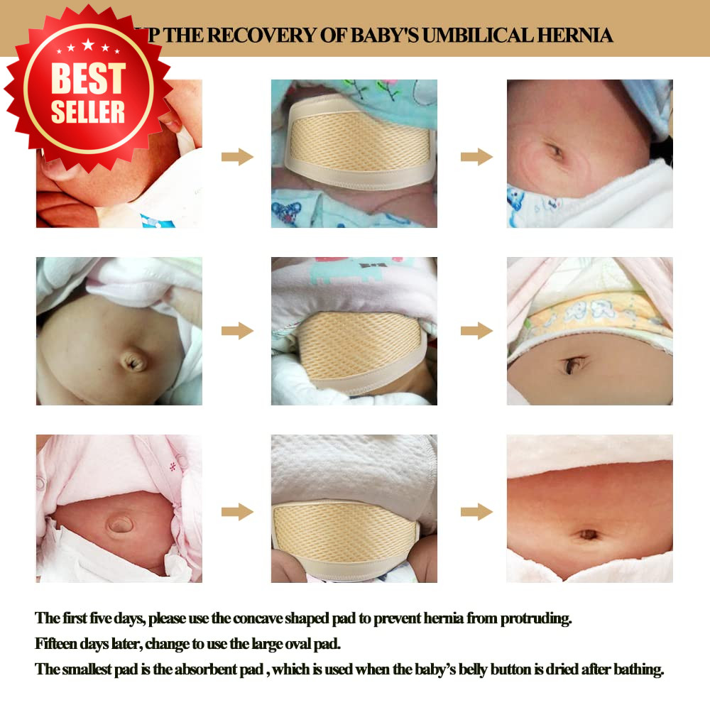 Baby Infant Umbilical Hernia Truss Support Abdominal Binder 15-20″ US