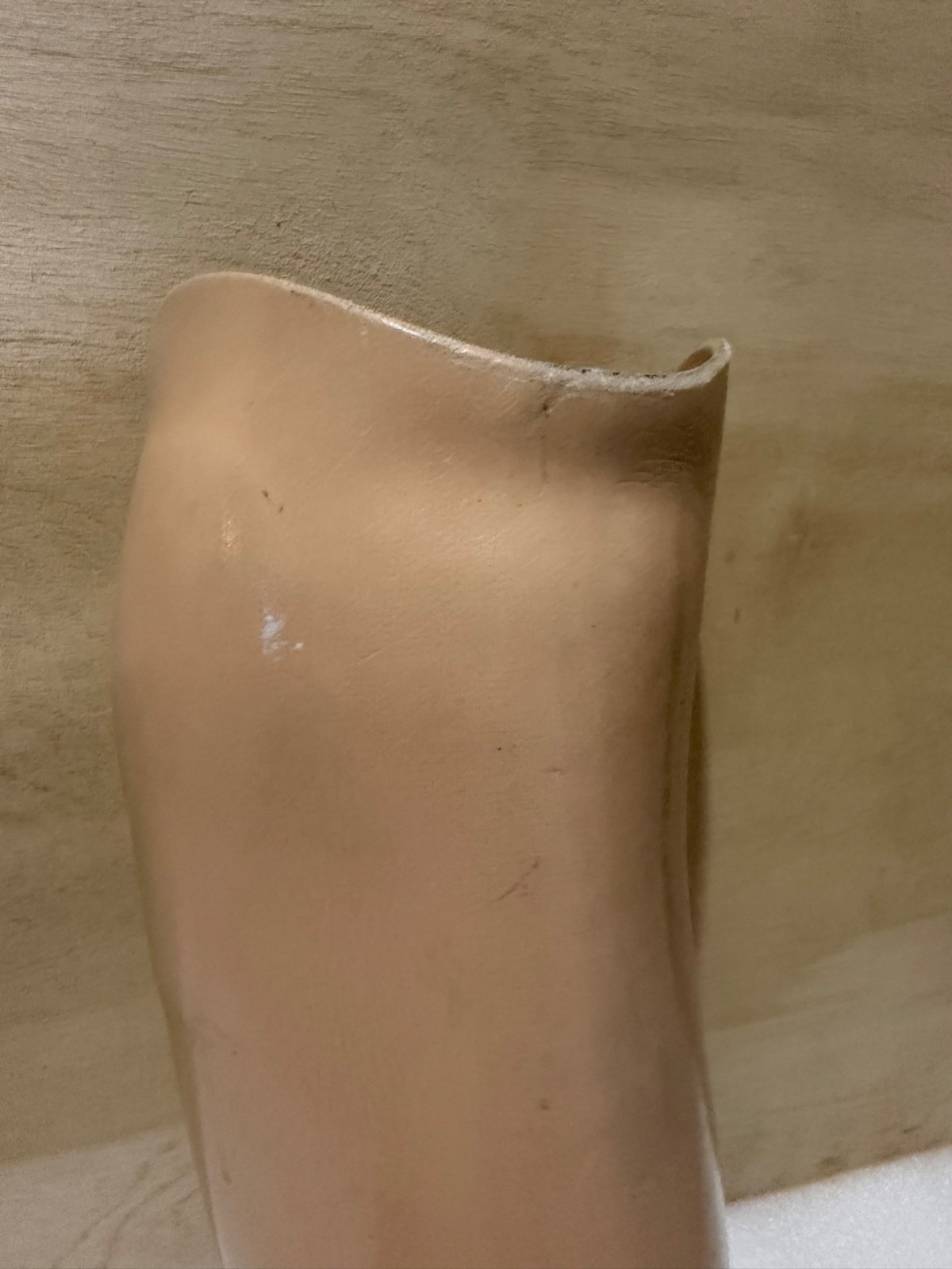 Prosthetic Socket With Pylon Hosmer USA Parts Ankle /College Park Breeze