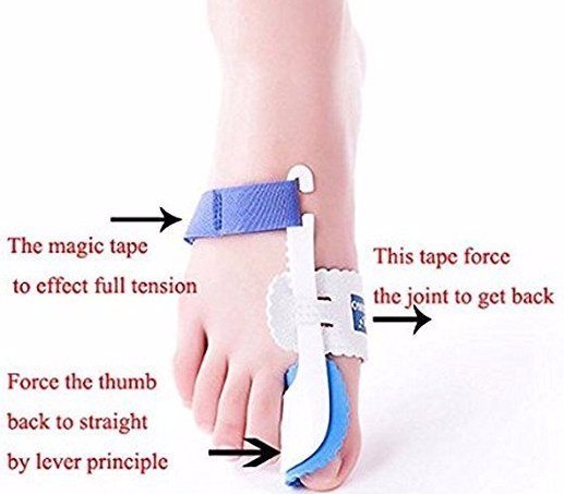 Toe Bunion Corrector & Relief Protector Treat Pain in Hallux Valgus Night Splint