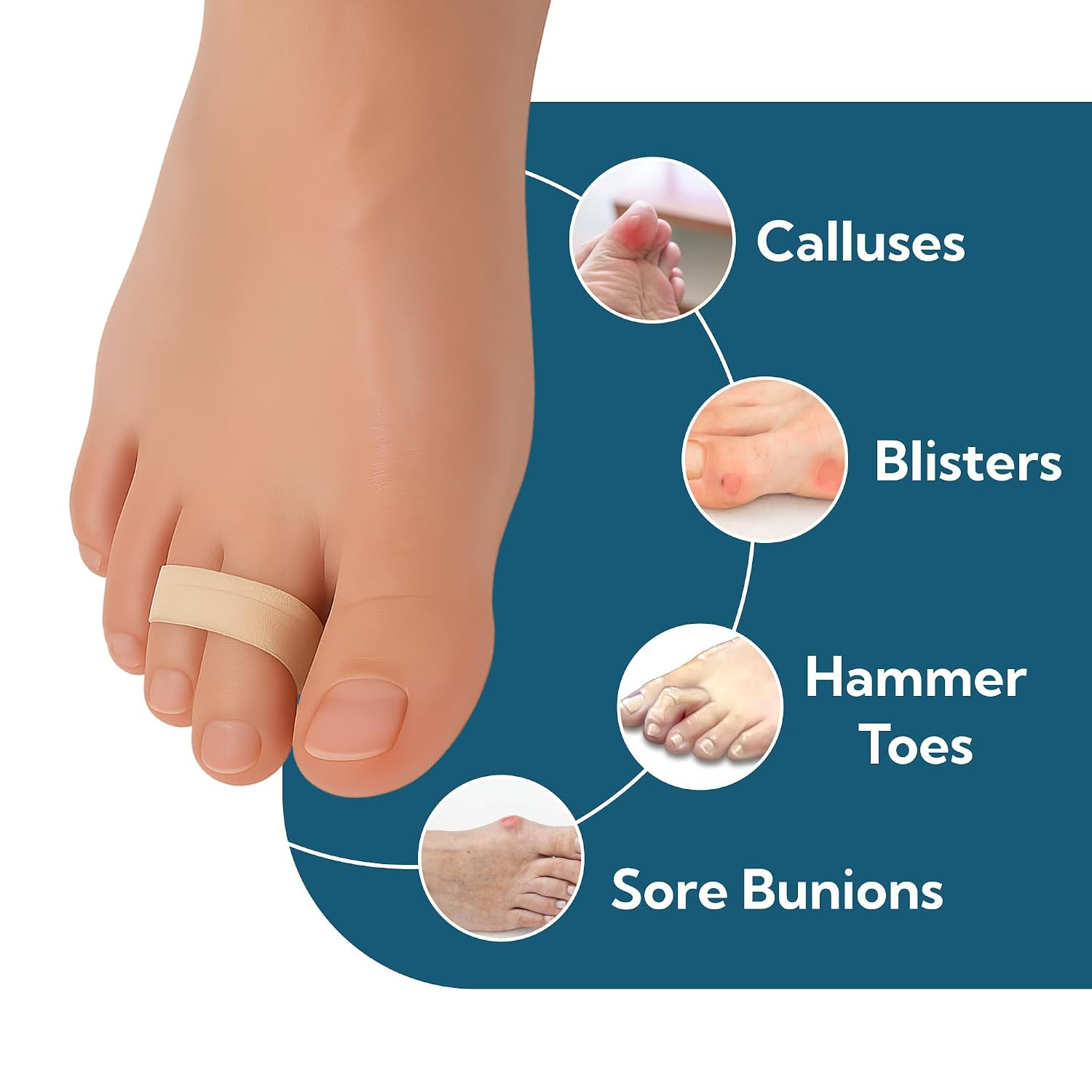 Hammertoe Corrector Buddy Splint Toe Wrap for Pain Relief – Podiatrist Recommend