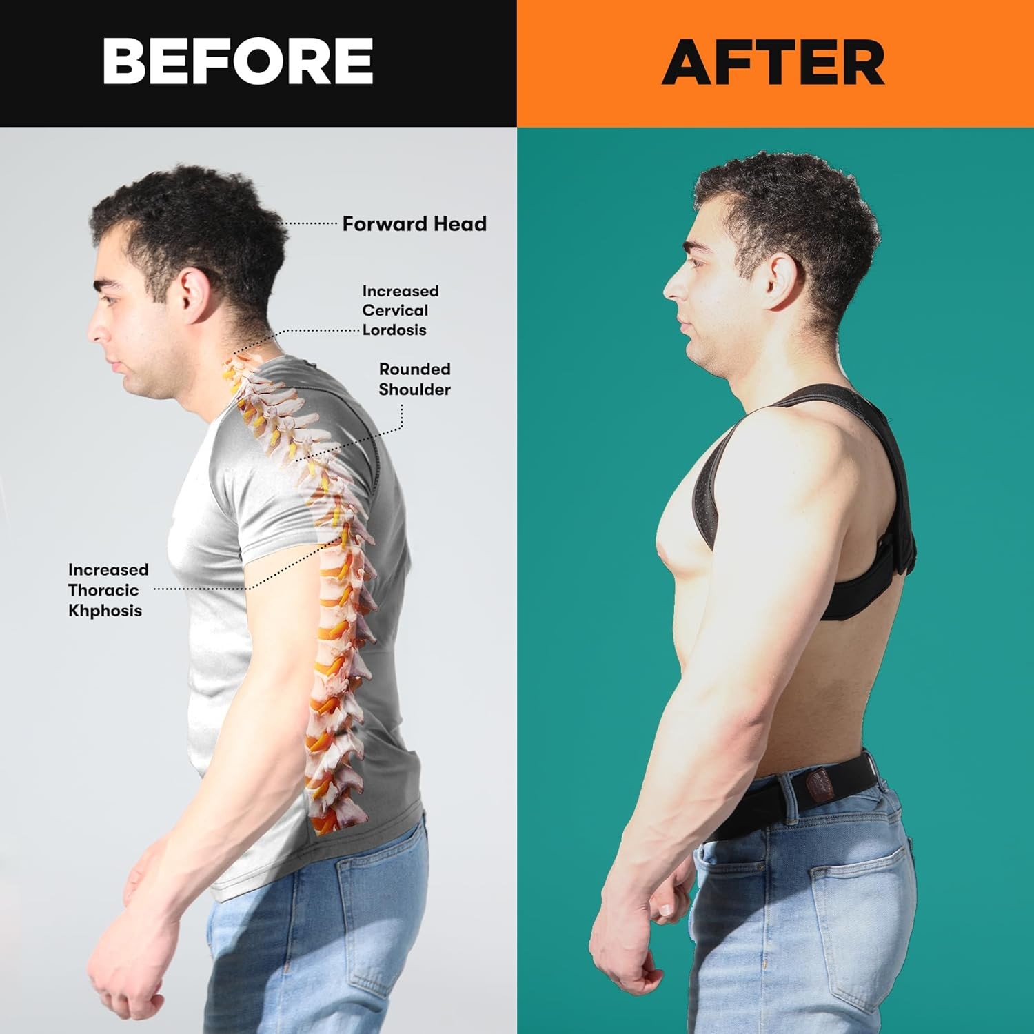 Premium Upper Back Brace for Men & Women, One Size