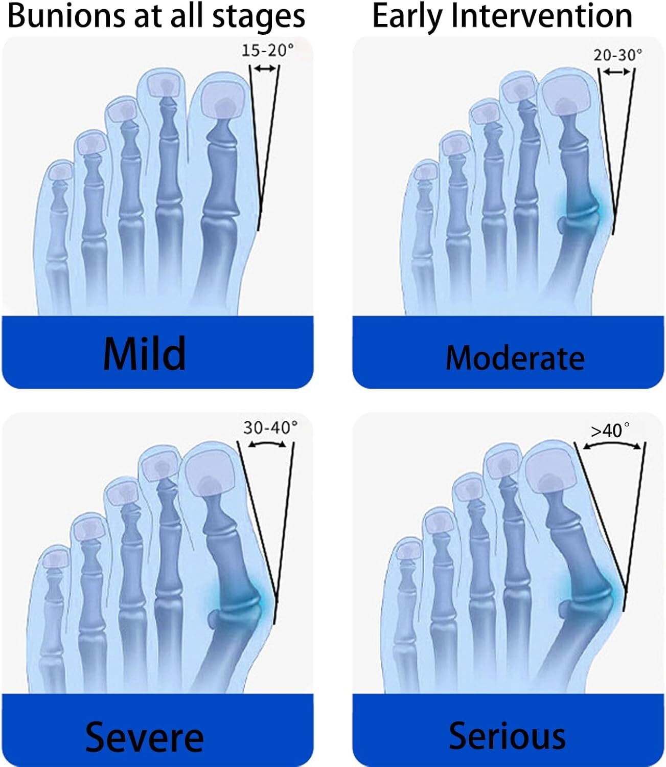 HALLUX TOE BUNION CORRECTOR STRAIGHTENER SUPPORT STRAP ORTHOPEDIC FOR MEN WOMEN