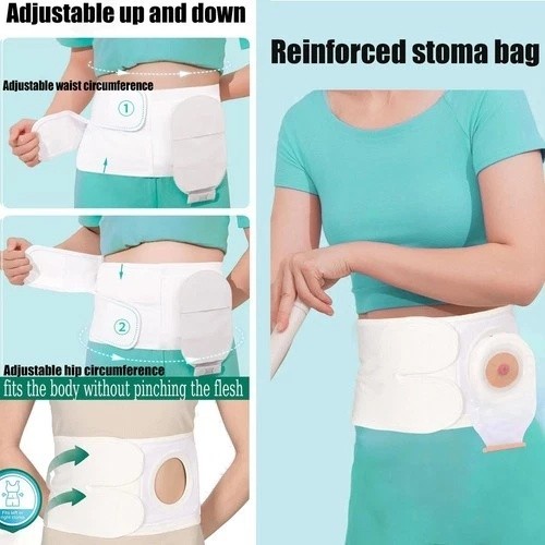 Flosmore Ostomy Support Belt，Adjustable Prevent Parastomal Hernia Support Bel…