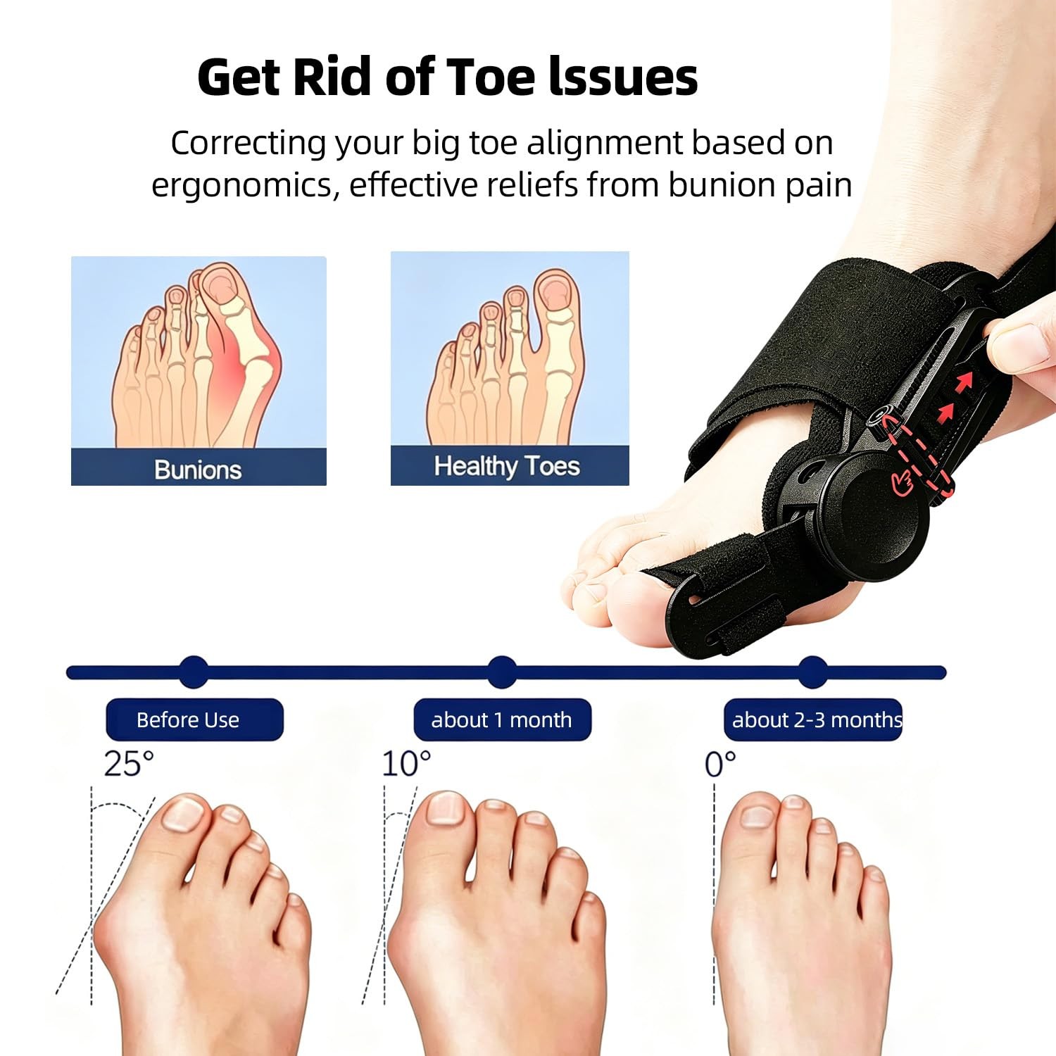 Aookellb Bunion Corrector for Women & Men, Adjustable Orthopedic Bunions…