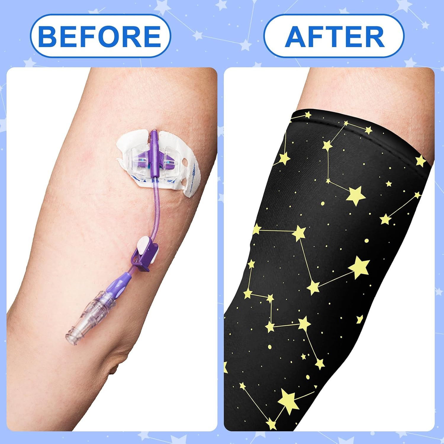 Cuffbow 12 Pcs PICC Line Reusable Sleeve Cover for Adults Upper Arm Breathable C