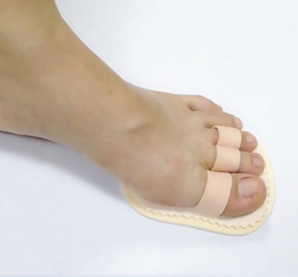1 Toe Splint Corrector Straightener Triple Toe Hammer Claw Overlapping Left Foot