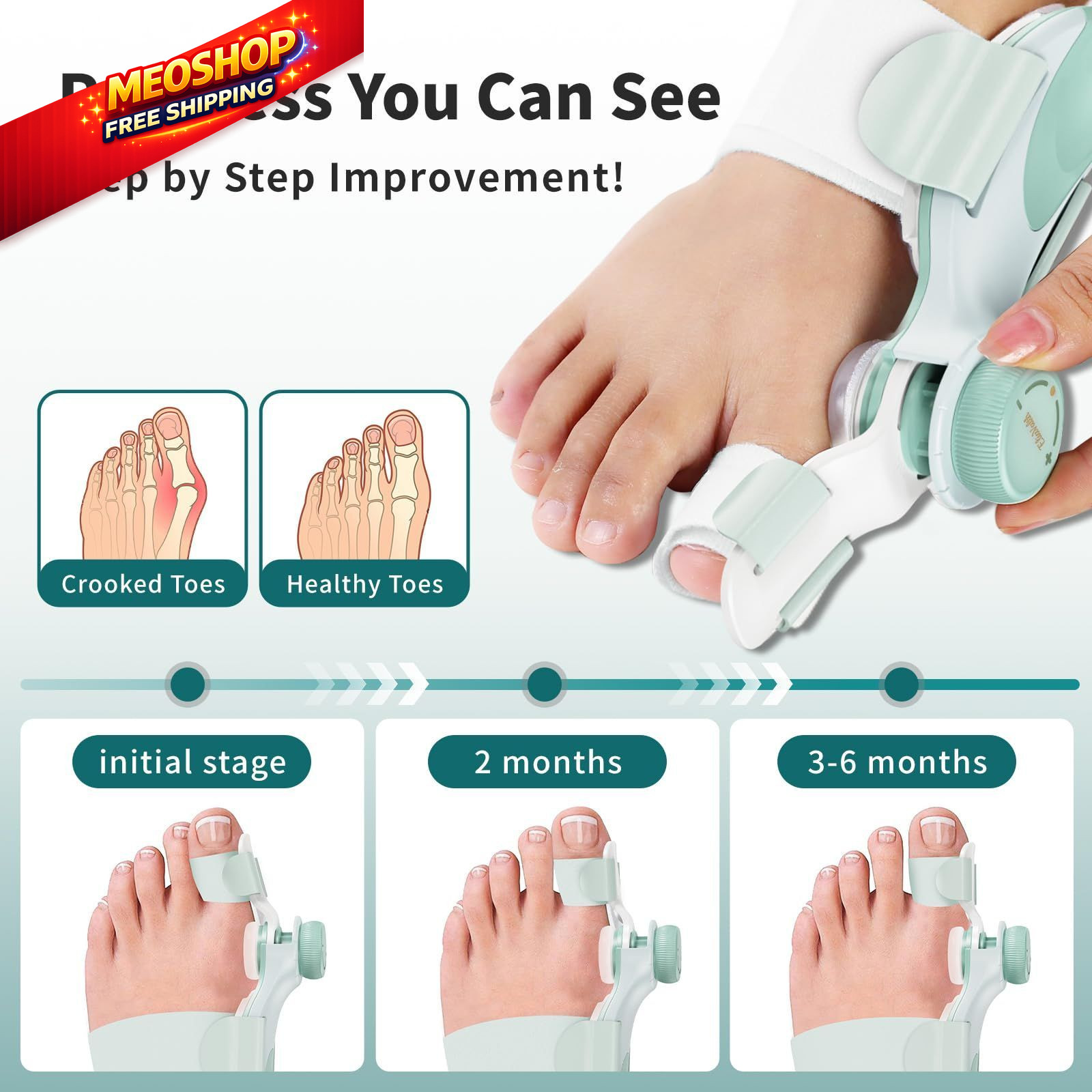 EliaValth 2 PCS Bunion Corrector for Women Big Toe, Adjustable Medium, Green