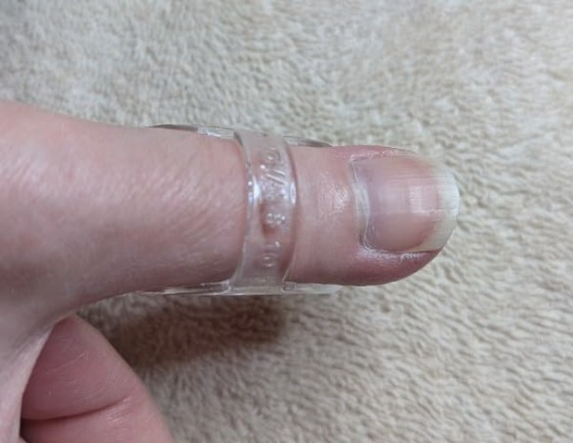 Comfort-Fit Oval-8 Finger Splint for Arthritis & Trigger Finger – Adult Size 13