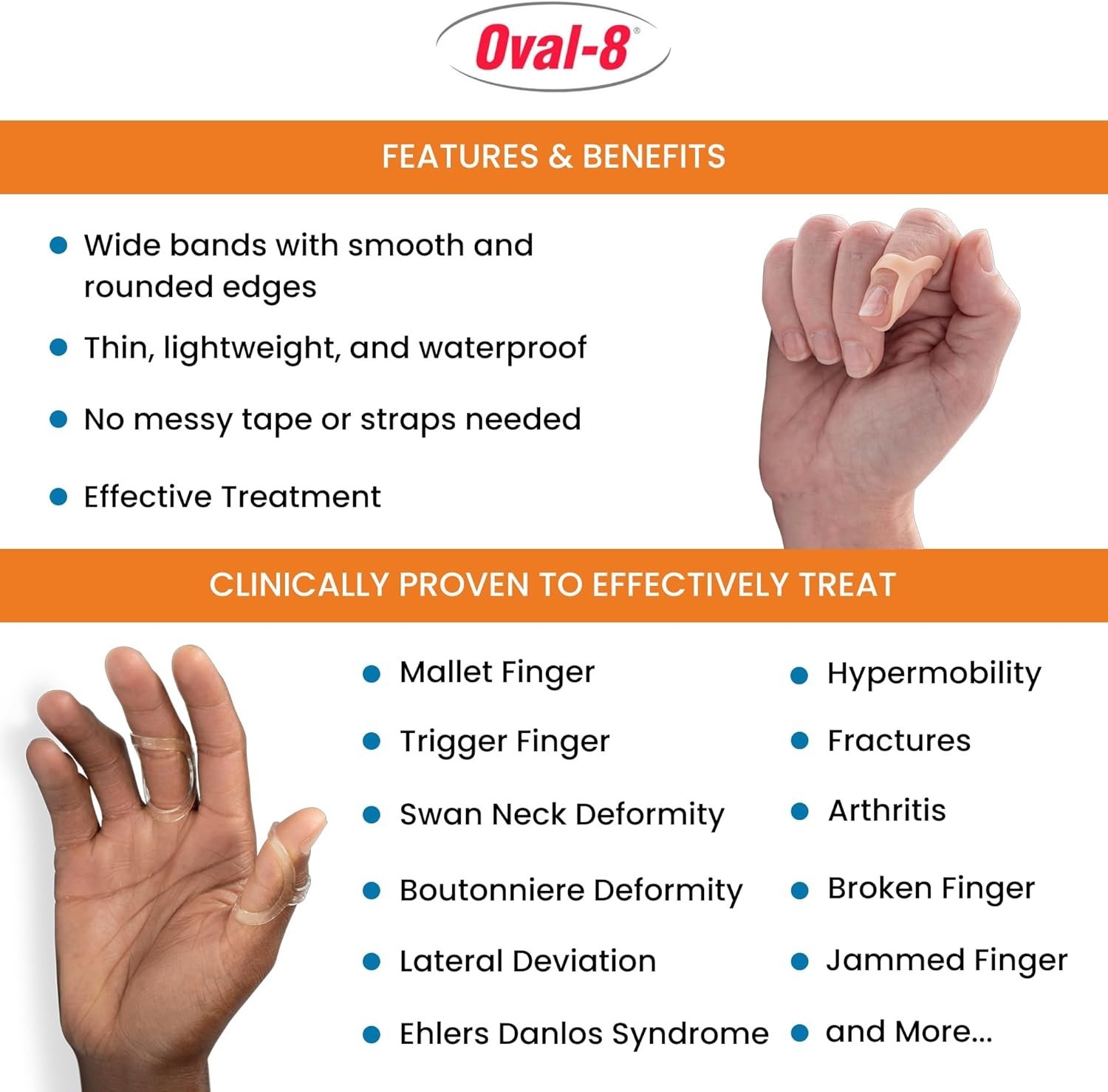 Versatile Oval-8 Finger Splints – 3 Sizes for Mallet, Trigger Finger & More